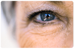 Degeneración macular 