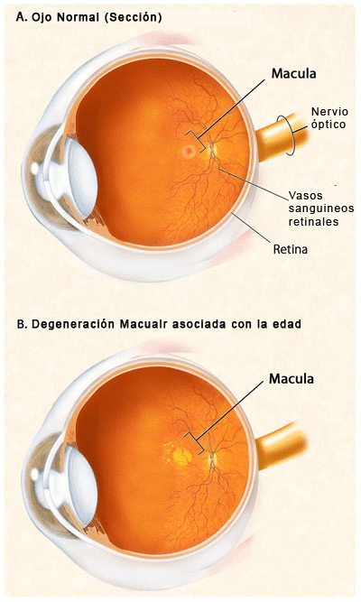 Esquema del Ojo