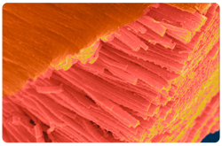 Fibras del musculo esqueletico