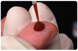 Diagnóstico de anemia