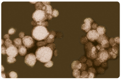 Lipoproteína de muy baja densidad (VLDL)