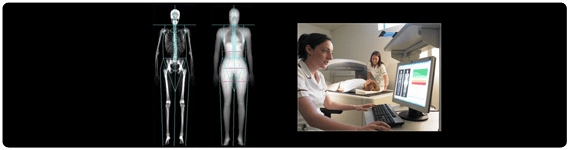 Absorciometría de rayos-X de energía dual 