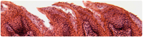 Micrografía de papilas filiformes en la zona posterior de la lengua