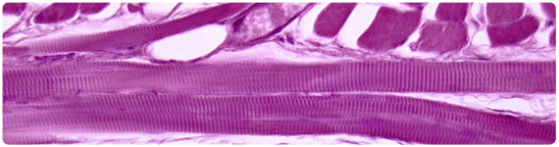 Músculo esquelético de la lengua