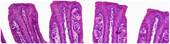 Seccion de la lengua mostrando las papilas foliáceas
