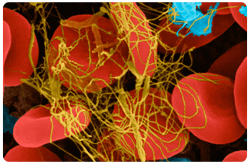 Proceso de coagulación: Eritrocitos y trombocitos en fibrina