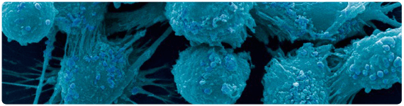 Microfotografia de células de la prostata cancerígenas