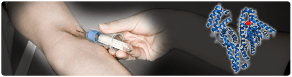 La enfermedad renal está estrechamente asociada con desnutrición proteínico-energética La enfermedad renal está estrechamente asociada con desnutrición proteínico-energética