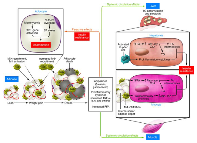 Obesidad, inflamación y resistencia a la insulina