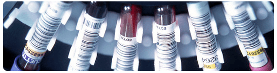 Herramientas de la genética molecular son aplicadas para probar si los genes del metabolismo de hierro alterados pueden ser un factor en varios desórdenes