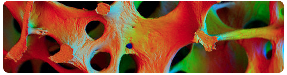 El riesgo a lo largo de la vida de fractura osteoporótica es 40% en mujeres y aproximadamente 15% en hombres