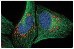 Micrografìa fluorescente: Detección de autofagia en células vivas