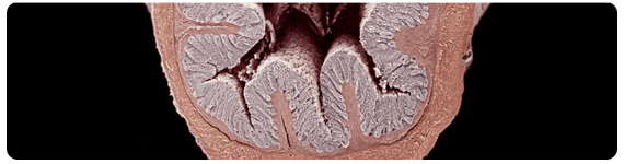 Sección transversal del colon